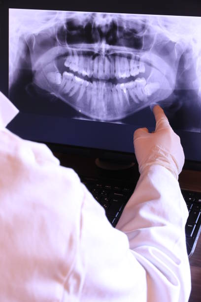 Best Emergency Dental Extractions in Morton, IL