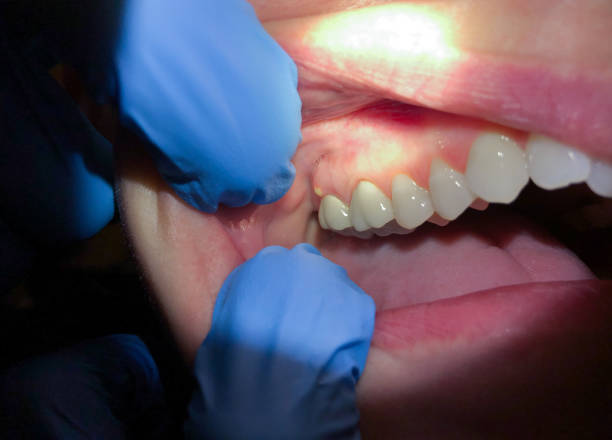 Best Pediatric Emergency Dentist in Morton, IL